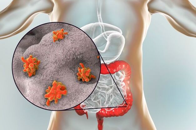 Τύποι παρασίτων στο ανθρώπινο σώμα