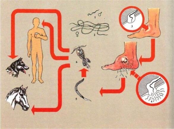 Ανάπτυξη δρακουνκουλιάσης
